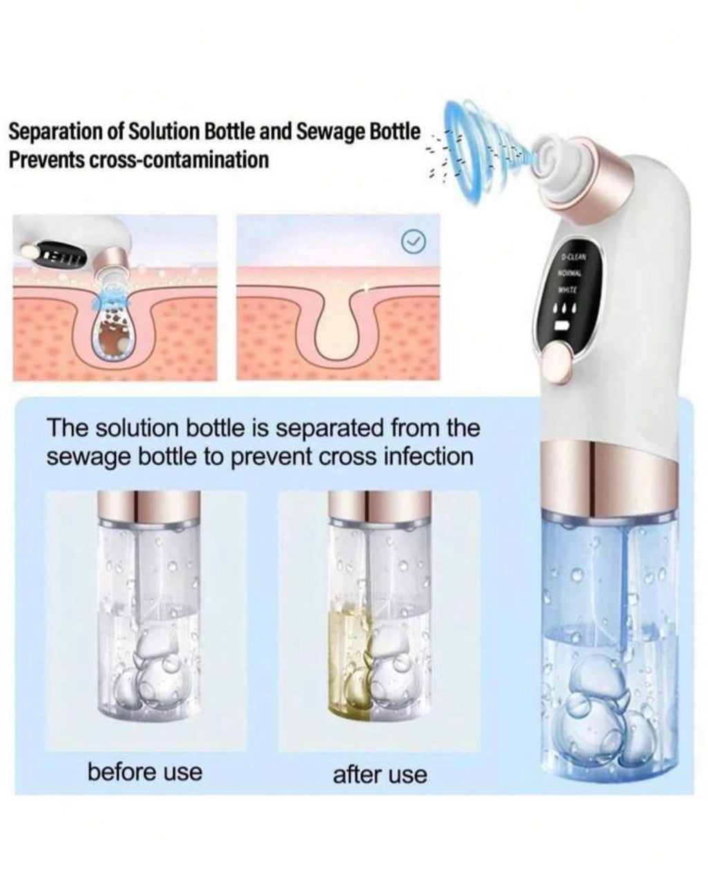 Electric blackhead remover