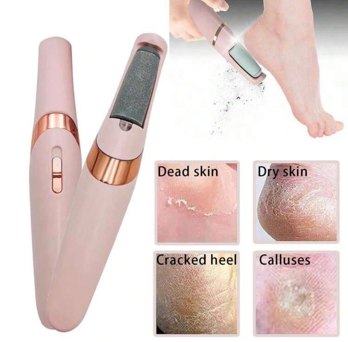 Electric foot callus remover