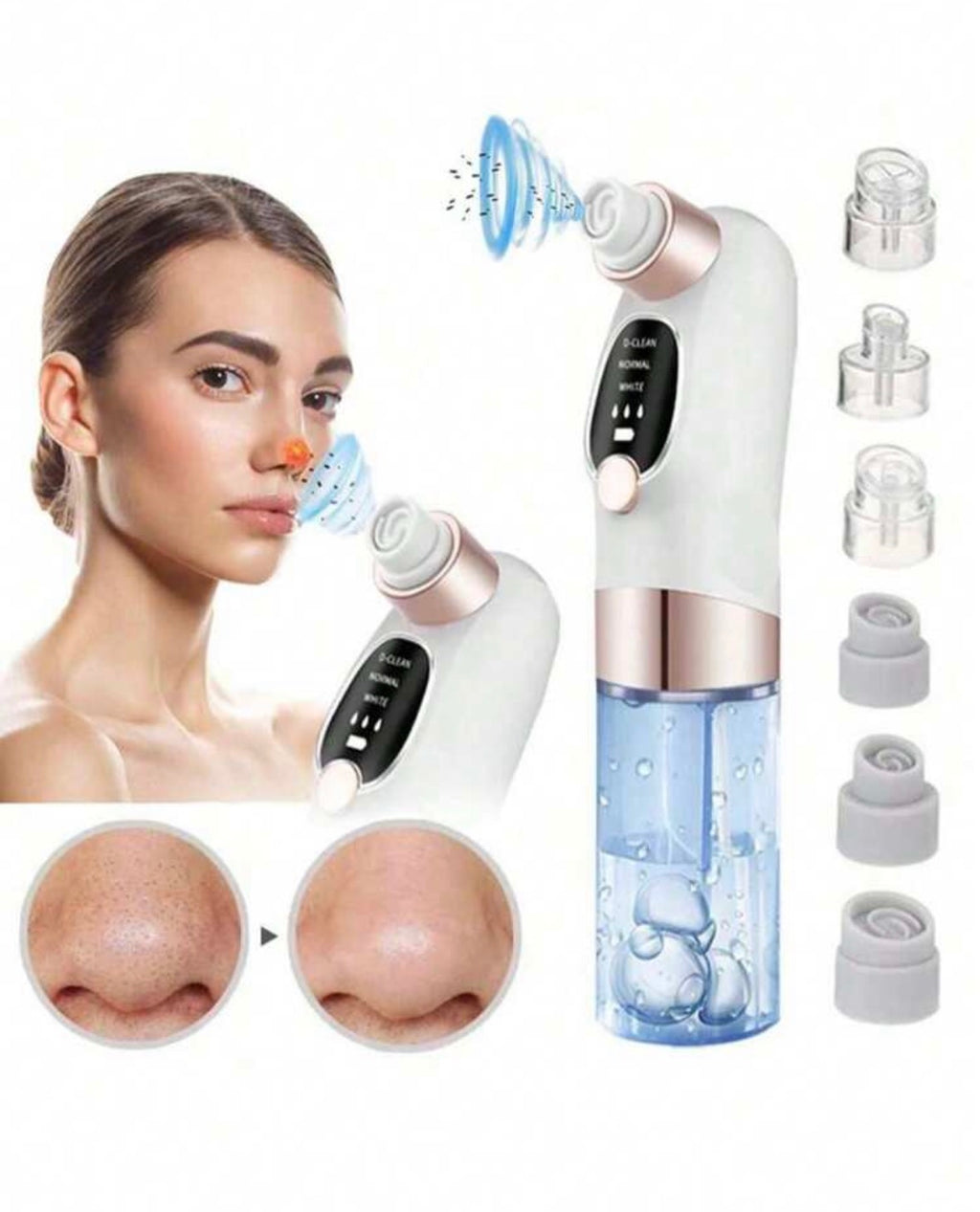 Electric blackhead remover