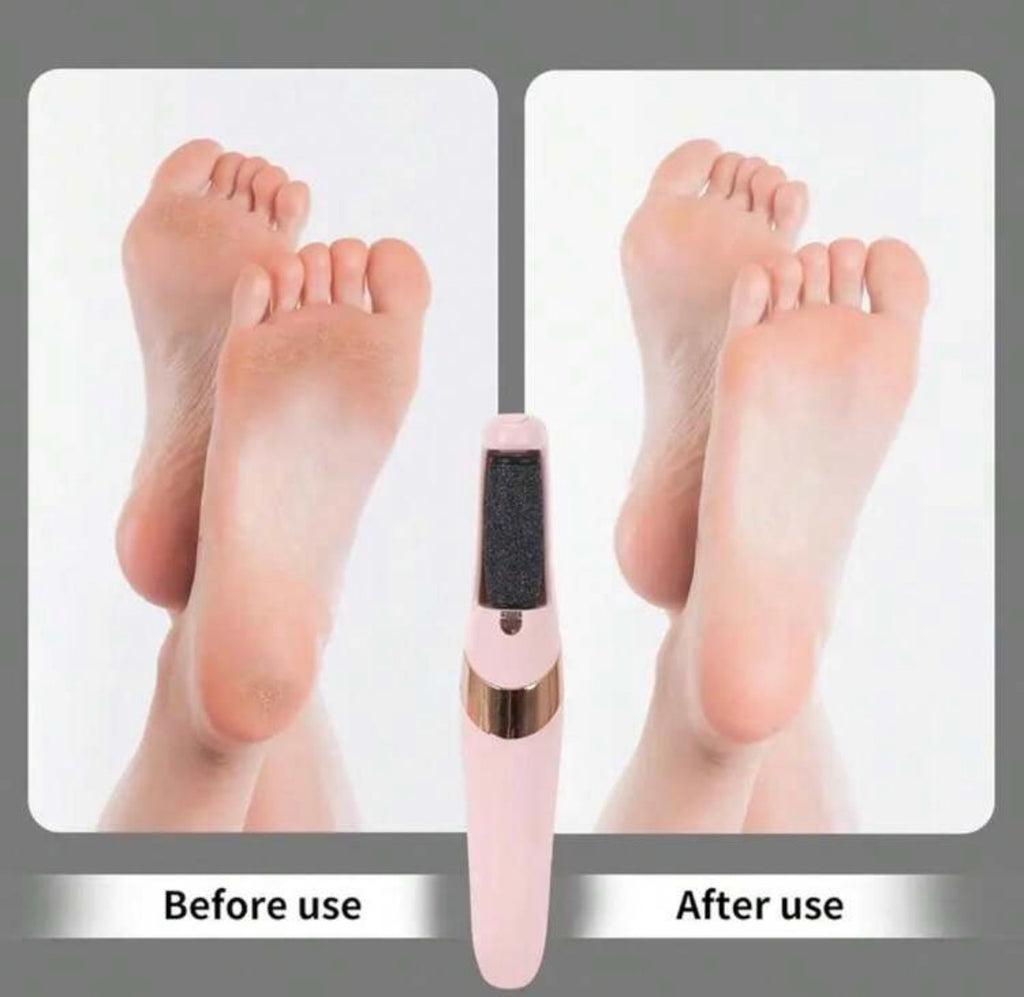 Electric foot callus remover